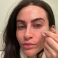 This TikTok-Viral Microneedling System is 70% Off Right Now — and Worth Every Penny